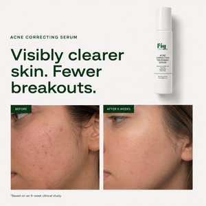Fig MD Acne Correcting Serum