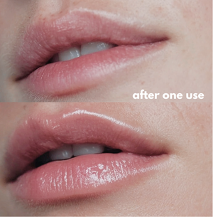 Fig MD Plumped by Fig